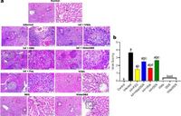 The antifibrotic effect of Vildagliptin and Diaminodiphenyl Sulfone in murine schistosomiasis mansoni - Scientific Reports