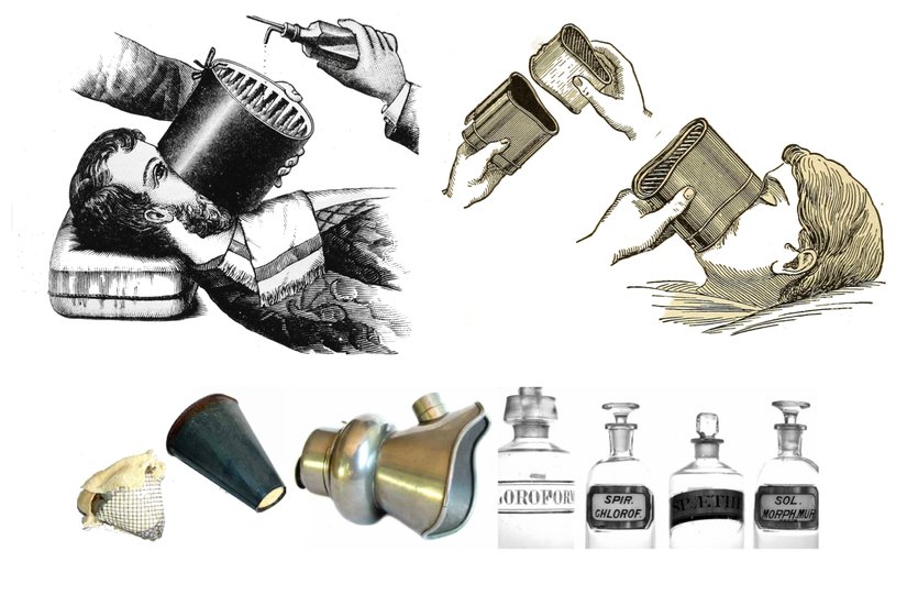 İlk zamanlarda kullanılan inhaler eter aletleri.