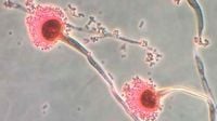 Killer fungus forecast to spread to UK as climate changes