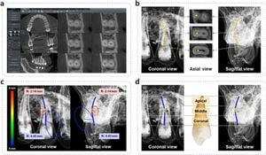 Three-Dimensional Imaging Enhances Understanding Of Root Canal Morphology