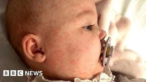 Falling Vaccination Rates Spark Measles And Whooping Cough Fears