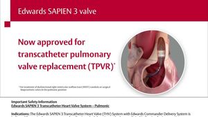 Promising Mid-Term Outcomes For Pulmonary Valve Replacement