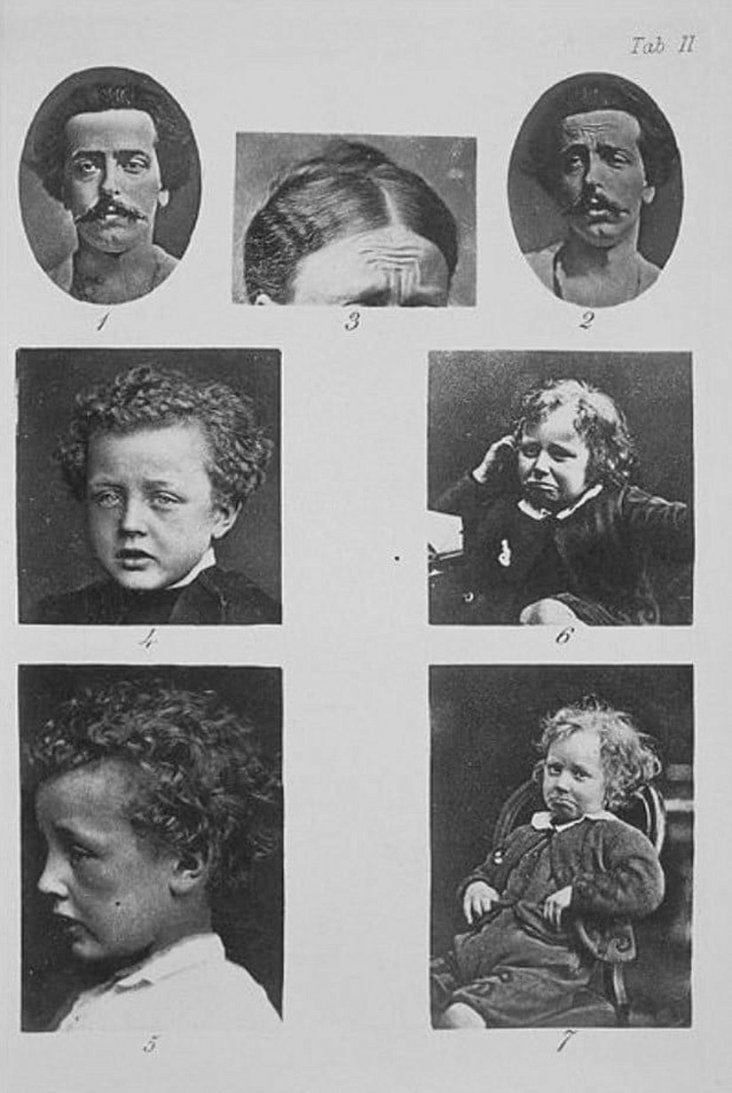 Düşük ruh halleri, endişe, keder, moral bozukluğu ve umutsuzluk.