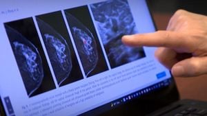 AI Detects Breast Cancer That Mammograms Missed