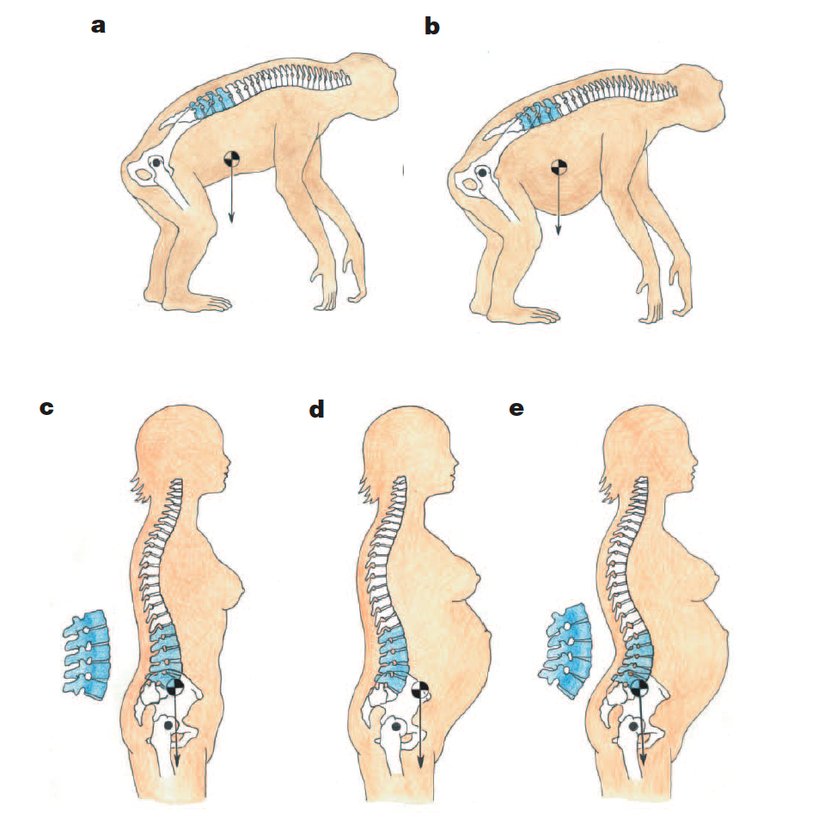Lumbar curvature has evolved in bipedal hominin females to solve the problem of the fetal load. A wedging in quadrupedal animals (those that predominantly use all four limbs for locomotion; depicted in the figure is a chimpanzee) would not only fail to solve the problem of a fetal load, but it'd also make it worse.