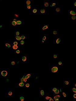 Tip-2 Diyabet Hastalarında Kan Pıhtısı Riskini Artıran Yeni Protein Keşfedildi!