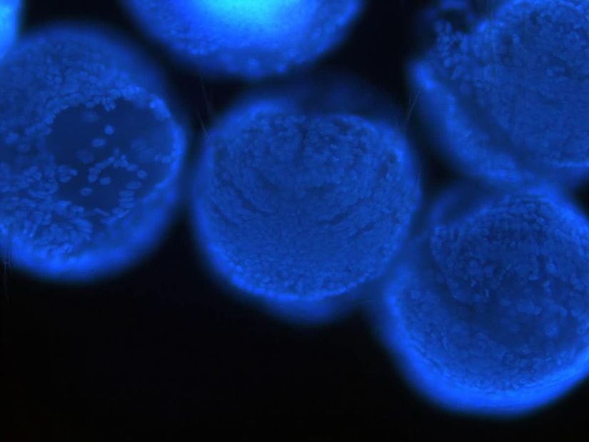 Two-day-old Platynereis dumerilii larvae with their DNA stained blue.