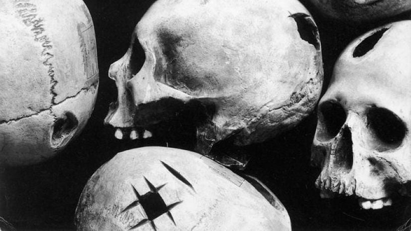 Trepanlanmış kafataslarına ait alçı kalıplar