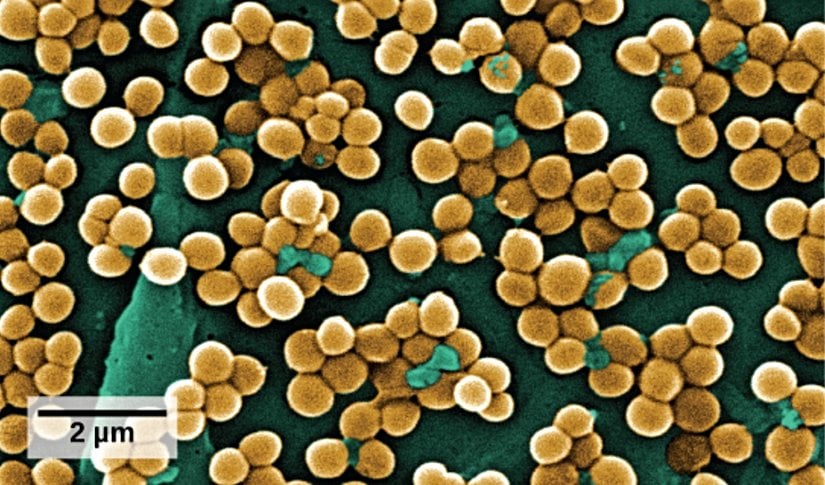 Elektron mikroskobu altında metisilin dirençli Staphylococcus aureus bakterisi.