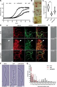 The stomatin-like protein StlP organizes membrane microdomains to govern polar growth in filamentous actinobacteria under hyperosmotic stress - Nature Communications