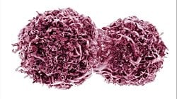 Kanser Biyolojisi: Tümör Tetikleyiciler ve Tümör Baskılayıcılar