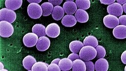 Vücudumuzda Doğal Olarak Bulunan Staphyloccocus aureus Bakterisi Nasıl Olur da Bizi Zehirler?