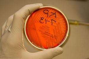 CDC Warns Of Sharp Rise In Deadly Drug Resistant Infections