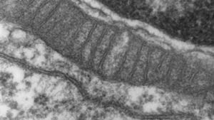 Breakthrough Discovery In Charcot's Disease Offers New Hope