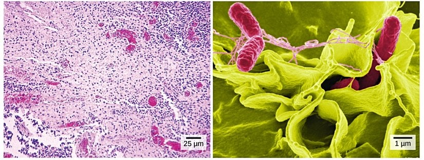 Soldaki görsel ışık mikroskobu ile gözlemlenmiş salmonella bakterisini göstermektedir. Sağdaki görsel ise taramalı elektron mikroskobuyla insan hücrelerini istila eden Salmonella bakterisini (kırmızı) göstermektedir.