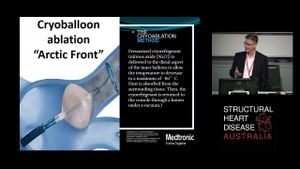 Long-term Outcomes Of Cryoballoon Vs Robotic Navigation For Atrial Fibrillation