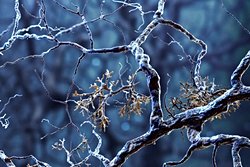 Araştırma, İnsan Beynindeki Alzheimer Moleküllerinin Yapısını Ortaya Çıkarıyor!