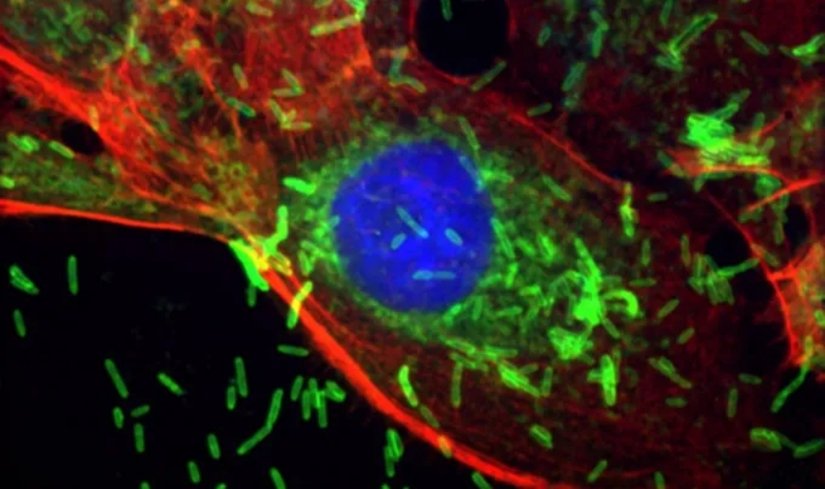Ağızda bulunan F. nucleatum bakterisi, laboratuvar ortamında bir insan meme kanseri hücresinin içine giriyor. Bu hücre, bakterinin yerleşmesine yatkın hale getirebilecek bir mutasyon taşıyor.