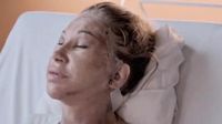 Horror-Bilder: Carmen Geiss zeigt neues Gesicht um 22.000 Euro