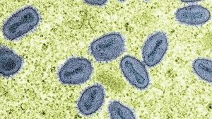 Severe Mpox Variant Spreads Locally In California