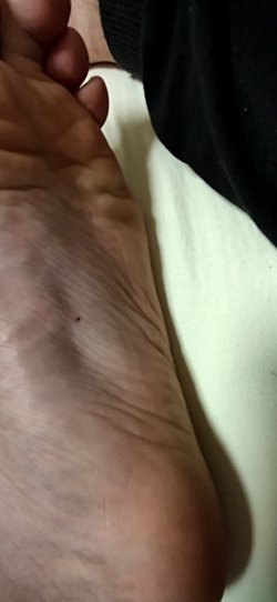 Tetanoz aşımi olaydan 65-67 saat sonra oldum herhangi bir sıkıntı olur mu?