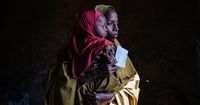 A $45 Treatment Can Save a Starving Child. US Aid Cuts Have Frozen the Supply