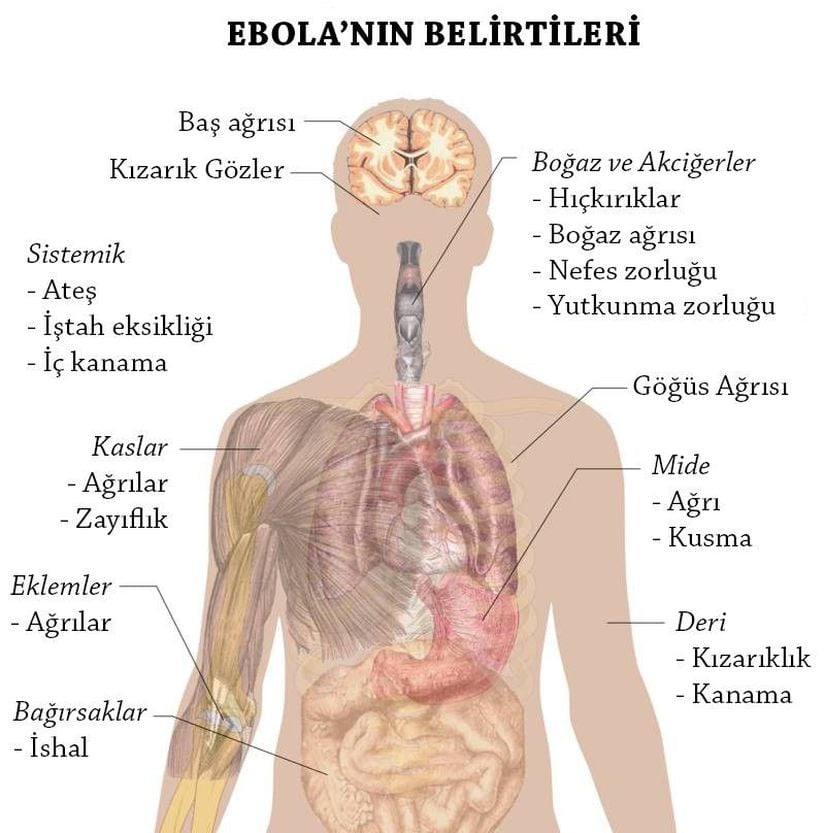 Dünya'da oldukça karışık tepkilerle karşılanan ve kiminin çok kısa sürede tüm dünyayı avuçları içerisine alacağını söylediği, kimi diğerlerininse bulaşma ihtimalinin çok düşük olmasından ötürü pek fazla yayılmayacağını söylediği bir hastalık ebola... Yine de, belirtilerinden haberdar olmakta fayda var diye düşünüyoruz. Unutmayın, bir hastalığın teşhisinin konulabilmesi için bu belirtilerin çoğunun bir arada gözükmesi lazım. Başınız ağrıyor diye Ebola olduğunuzu düşünmeyin. Ancak şüphe duyuyorsanız, mutlaka doktora başvurun.