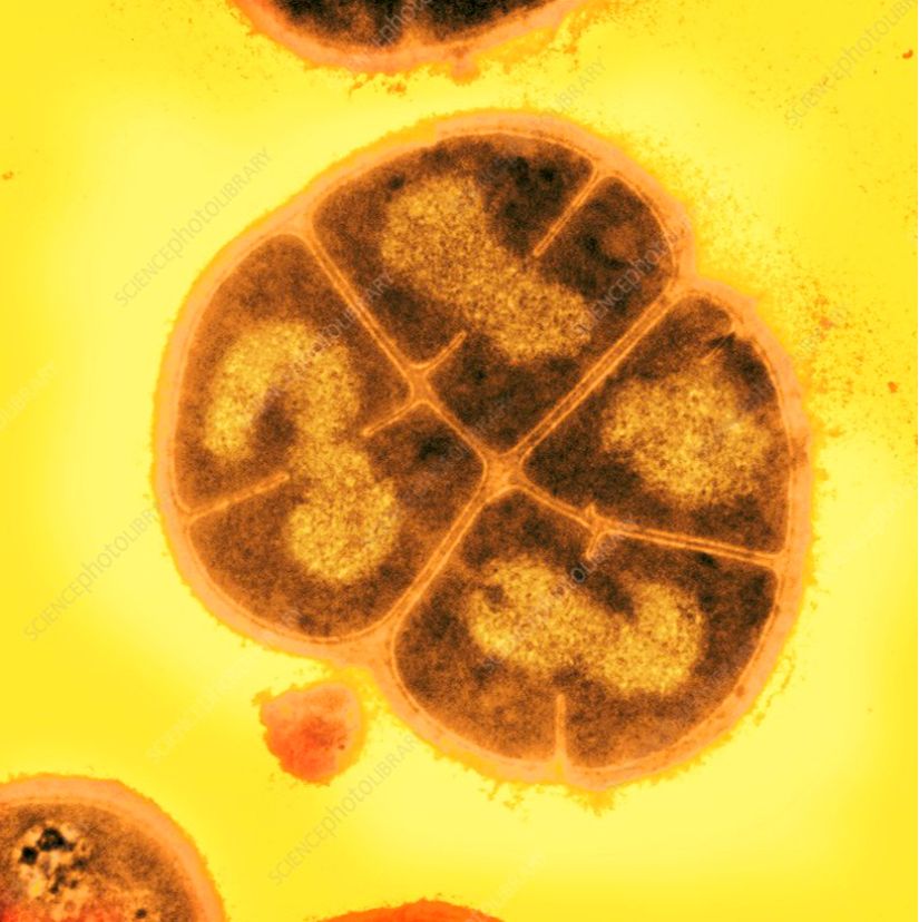 Deinococcus radiodurans türüne ait bir birey.