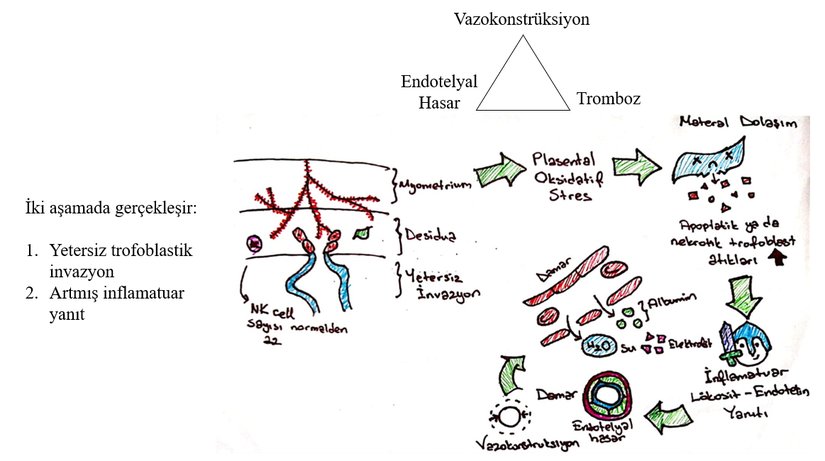 Preeklampside Plasentasyon