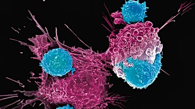 Kanser Tedavisinde Canlı İlaçlar: İmmünoterapi ve CAR-T Hücreleri