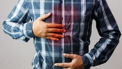 Gastroözofageal Reflü Hastalığı Nedir,Belirtileri ve Tedavi Yöntemleri
