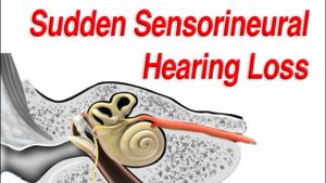 Defibrinogen Therapy Boosts Recovery Rates For Hearing Loss