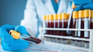 UK Scientists Unveil Breakthrough Blood Test For ME/CFS