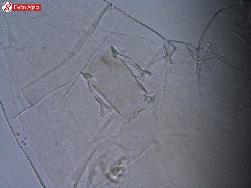 Milnesium sp. bukkal faringeal aparat.