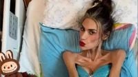 Nihal Candan öldü mü! Anoreksiya ile Mücadele Eden Fenomenin Acı Sonu Geldi
