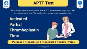 New Technique Improves Plasma Coagulation Assessment For Bleeding Patients