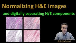 New Breakthrough Model Enhances Histopathology Image Analysis