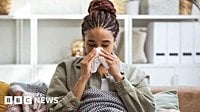 Flu cases in Scotland drop by more than a third
