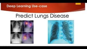 Revolutionary AI Techniques For Lung Disease Detection