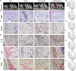 Ortodontide Fazla Kuvvet, Diş Hareketini Yavaşlatıyor!