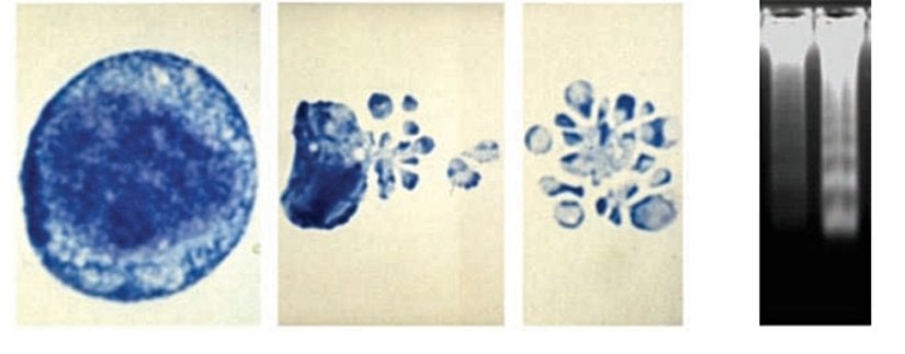 Solda, temel morfolojik özelliklerden olan hücre zarı parçalanması aşama aşama görülmekte. Sağdaki elektroforez sonucu ise DNase enzimleri tarafından binlerce ve farklı uzunlukta fragmente ayrılmış DNA'yı göstermektedir; bu tarz sonuçlara "smear" denir.