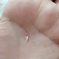 Ev kedileri ile sokak kedileri arasında diş dökme ve diş gelişimleri  bakımından fark var mı?