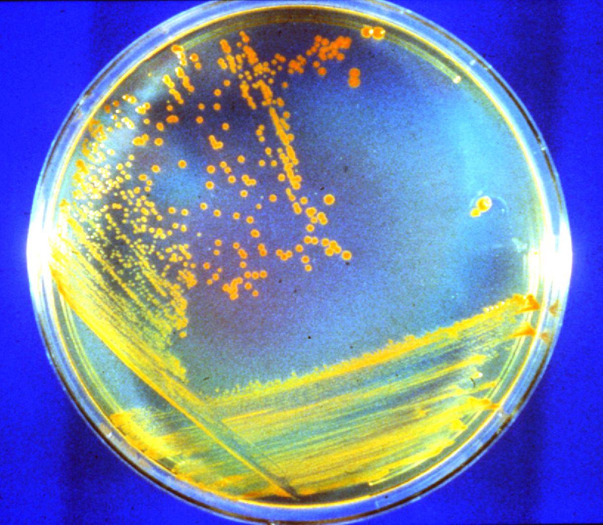 D. rad Bacteria: Candidate Astronauts