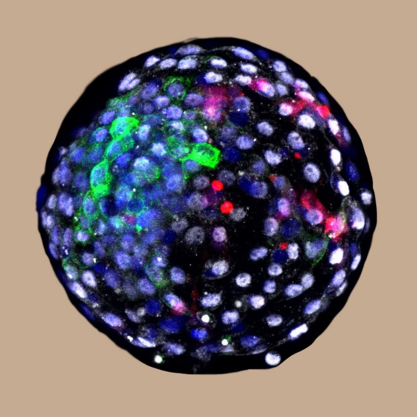 Bu görüntü, insan ve makak maymun melezi embriyoyu gösteriyor. Araştırmacılar, floresan lekeleri kullanarak, erken evre embriyoda farklı tür kökenlerine sahip hücreleri görselleştirebilirler.