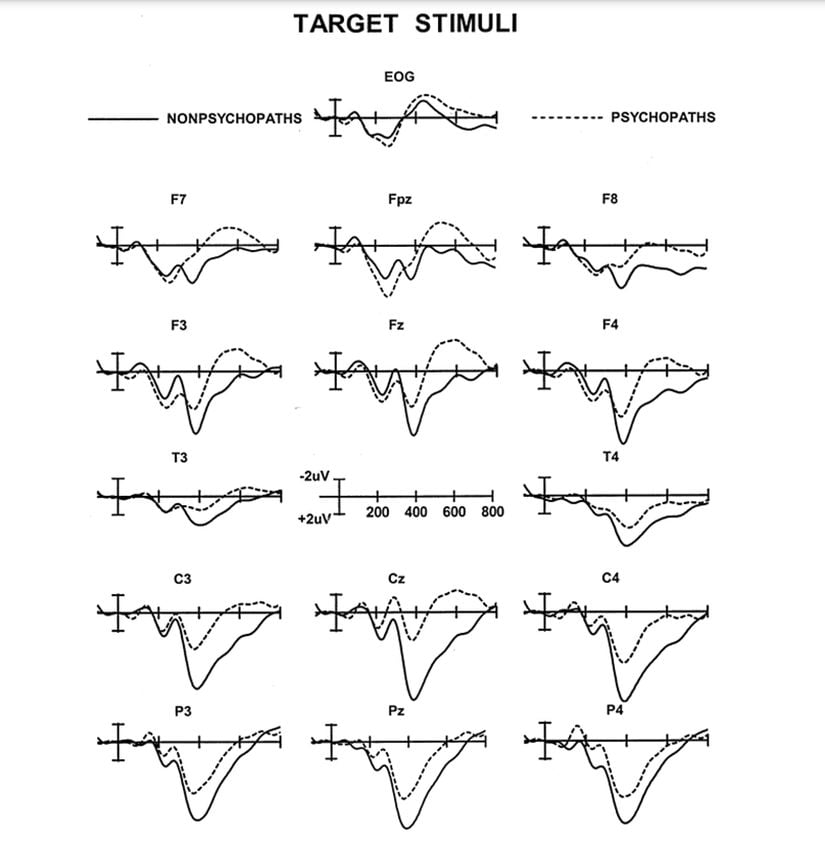 Şekil 5: Psikopatlar ve Psikopat olmayanlar için hedef uyaranlara yönelik büyük ortalamalı ERP'lerin karşılaştırılması. EOG, elektrookülogram
