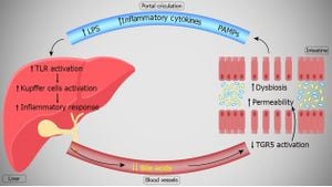 Gut Microbiota-Derived H2S Triggers Liver Disease Progression