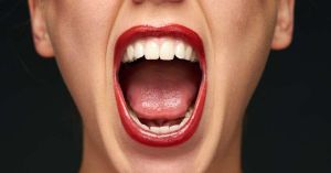 Cysteine Challenge Test Improves Halitosis Diagnosis With Standardization