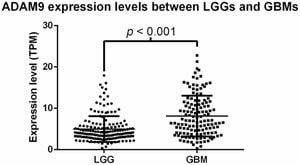 ADAM12 Identified As Critical Biomarker For Glioma Prognosis